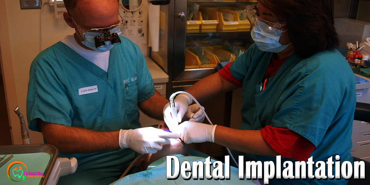 Amazing Dental Implant Can Grow New Teeth In Your Mouth